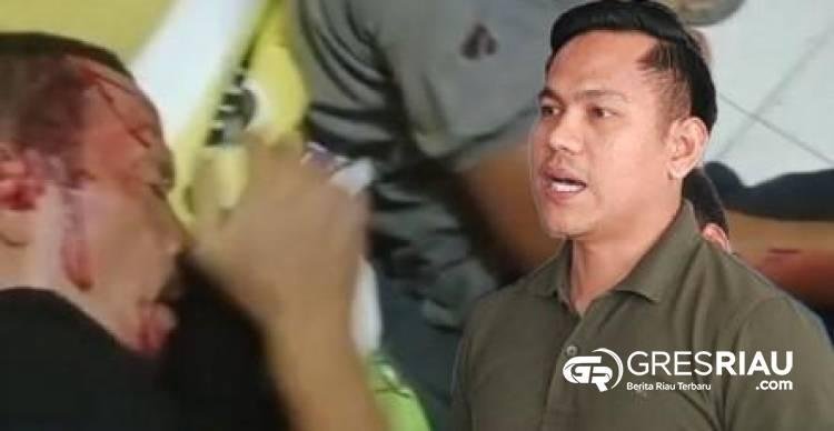 Kapolres Kampar Janji Profesional, Tapi Terduga Pelaku Pengeroyokan Masih Bebas