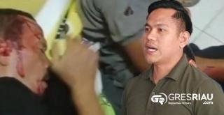 Kapolres Kampar Janji Profesional, Tapi Terduga Pelaku Pengeroyokan Masih Bebas