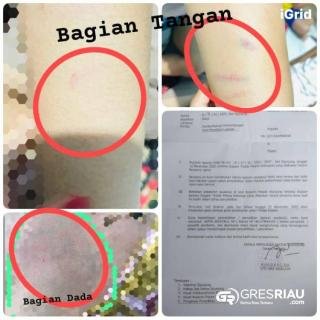 Oknum Pegawai KUA Sijunjung Diduga Aniaya Tetangga Merupakan Ibu dan Anak!